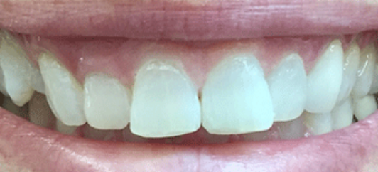 After - studleydental