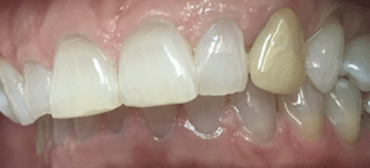 Before - studleydental