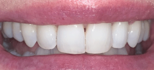 After - studleydental
