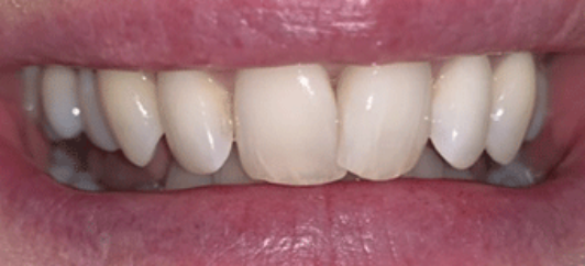 Before - studleydental