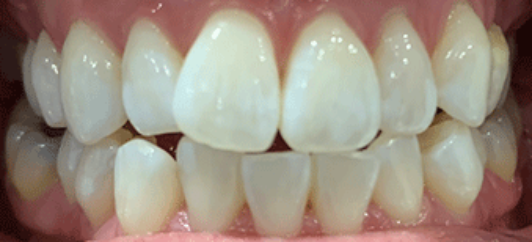 After - studleydental