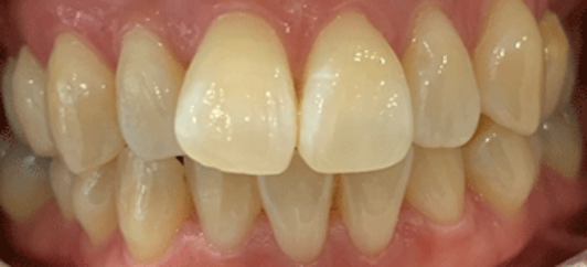 Before - studleydental
