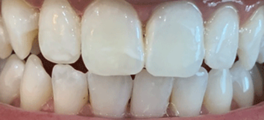 After - studleydental