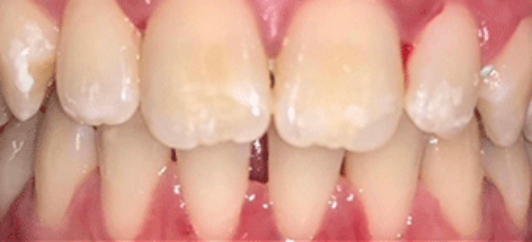 Before - studleydental