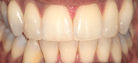 After - studleydental