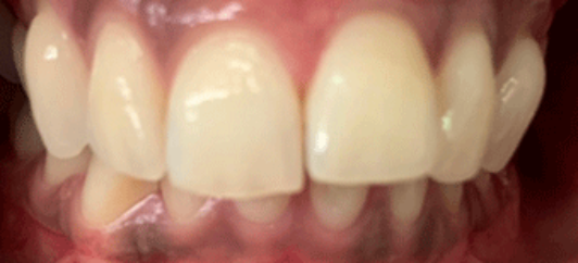 Before - studleydental