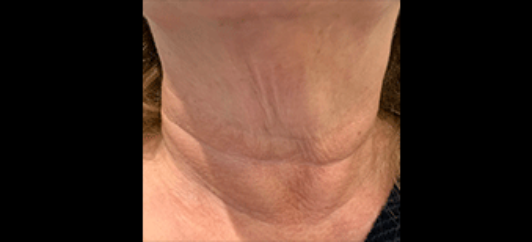 After - studleydental