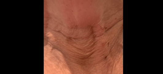 Before - studleydental
