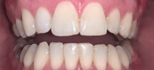 After - studleydental