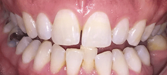 Before - studleydental
