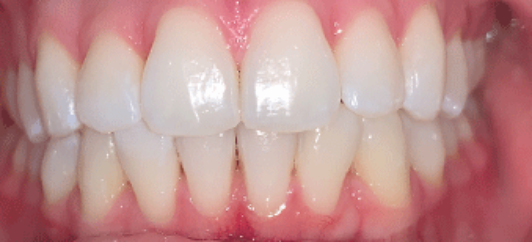 After - studleydental
