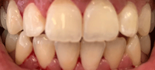 After - studleydental