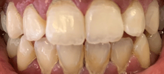 Before - studleydental