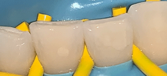 After - studleydental