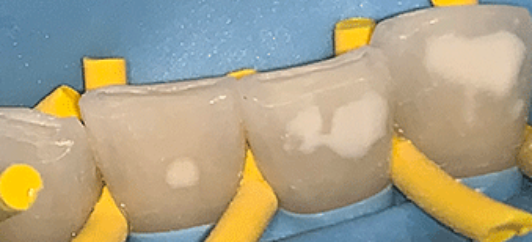 Before - studleydental