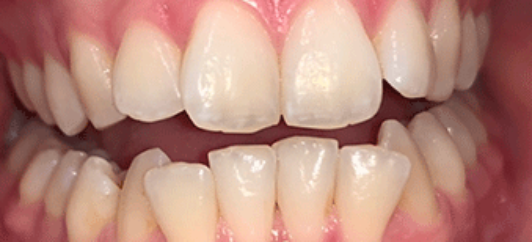 Before - studleydental