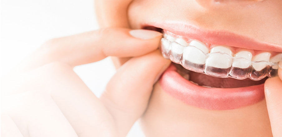invisalign thumb 